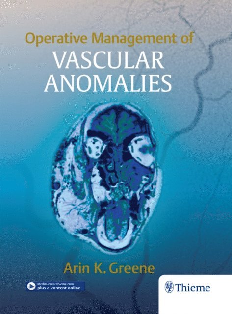 Arin Greene - Operative Management of Vascular Anomalies, E-bok