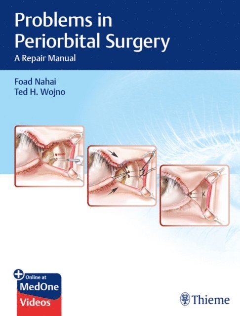 Ted H. Wojno, Foad Nahai - Problems in Periorbital Surgery, E-bok