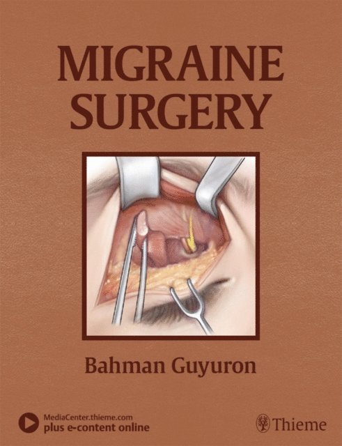 Bahman Guyuron - Migraine Surgery, E-bok