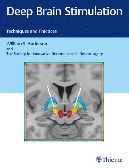 William S. Anderson - Deep Brain Stimulation, E-bok