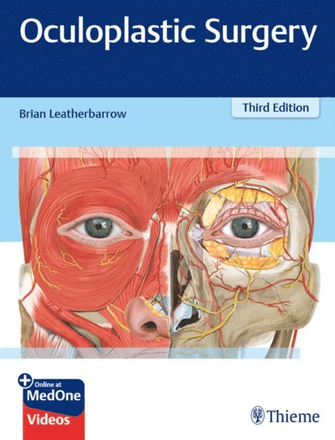 Brian Leatherbarrow - Oculoplastic Surgery, E-bok