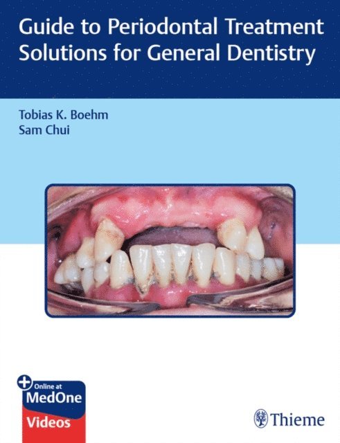 Sam Chui, Tobias K. Boehm - Guide to Periodontal Treatment Solutions for General Dentistry, E-bok