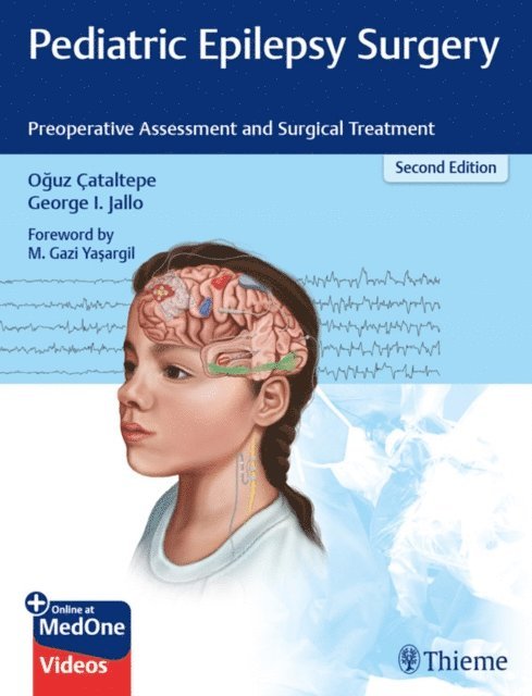 George I. Jallo, Oguz Cataltepe - Pediatric Epilepsy Surgery, E-bok