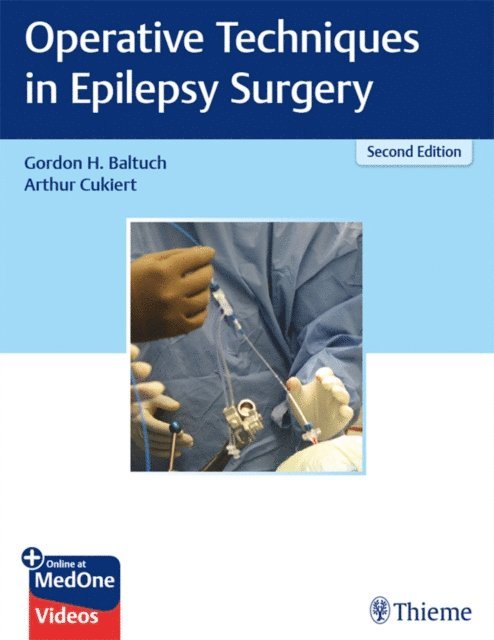 Arthur Cukiert, Gordon H. Baltuch - Operative Techniques in Epilepsy Surgery, E-bok