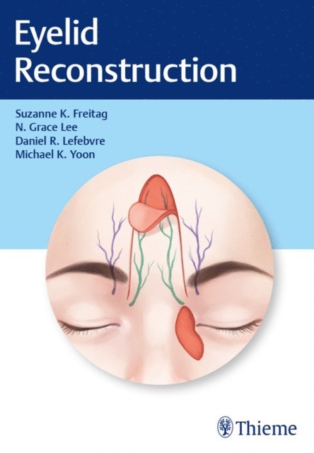 Michael K. Yoon, Daniel R. Lefebvre, Nahyoung Grace Lee, Suzanne K. Freitag - Eyelid Reconstruction, E-bok