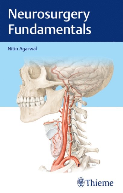 Nitin Agarwal - Neurosurgery Fundamentals, E-bok