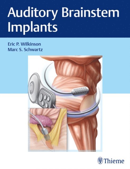 Marc S. Schwartz, Eric P. Wilkinson - Auditory Brainstem Implants, E-bok