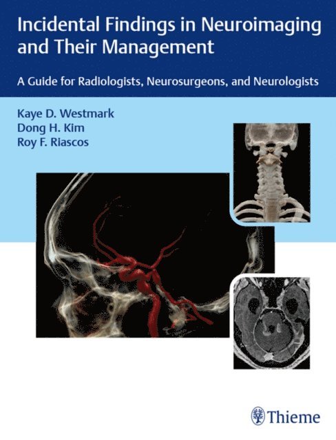 Roy F. Riascos-Castaneda, Dong H. Kim, Kaye D. Westmark - Incidental Findings in Neuroimaging and Their Management, E-bok