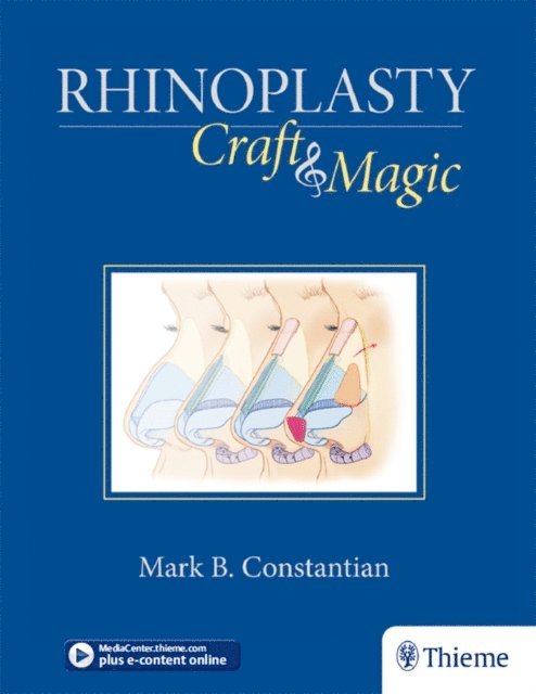 Mark Constantian - Rhinoplasty, E-bok