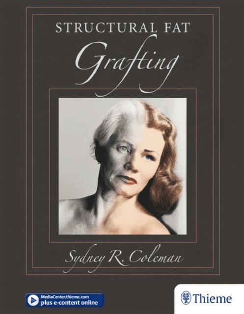 Sydney Coleman - Structural Fat Grafting, E-bok