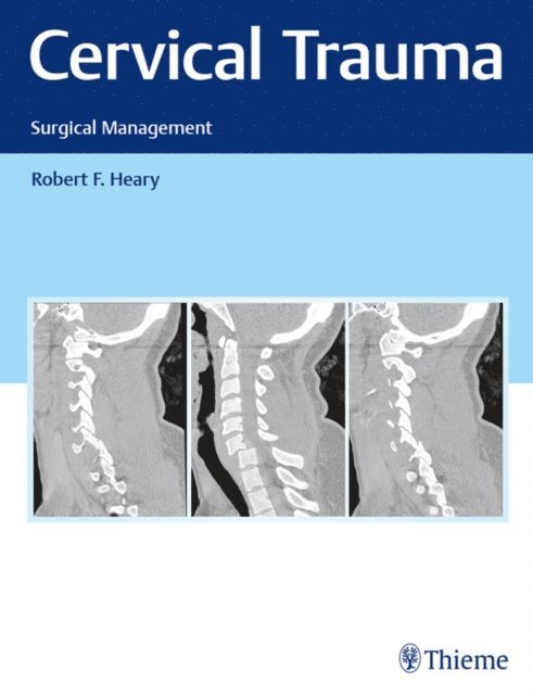Robert F. Heary - Cervical Trauma, E-bok