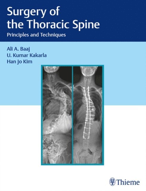 Han Jo Kim, U. Kumar Kakarla, Ali A. Baaj - Surgery of the Thoracic Spine, E-bok