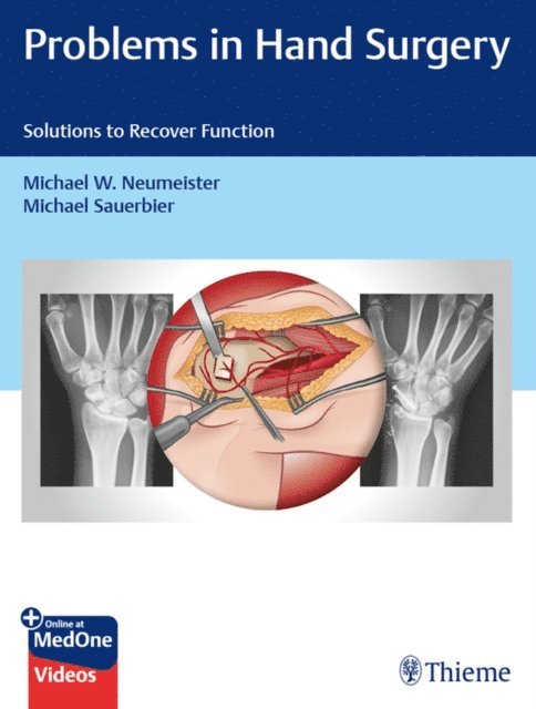 Michael Sauerbier, Michael W. Neumeister - Problems in Hand Surgery, E-bok