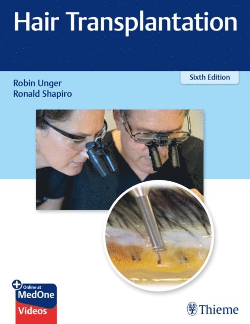 Ronald Shapiro, Robin Unger - Hair Transplantation, E-bok
