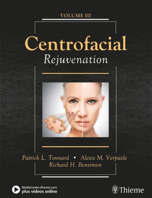 Richard Bensimon, Alexis Verpaele, Patrick Tonnard - Centrofacial Rejuvenation, E-bok