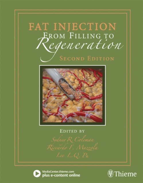 Lee Pu, Riccardo Mazzola, Sydney Coleman - Fat Injection, E-bok