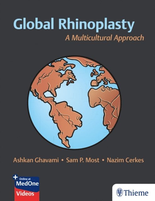 Nazim Cerkes, Sam P. Most, Ashkan Ghavami - Global Rhinoplasty, E-bok