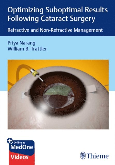 William B. Trattler, Priya Narang - Optimizing Suboptimal Results Following Cataract Surgery, E-bok