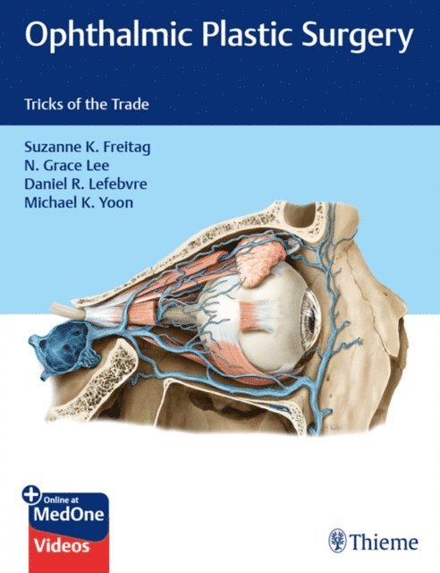 Michael K. Yoon, Daniel R. Lefebvre, Nahyoung Grace Lee, Suzanne K. Freitag - Ophthalmic Plastic Surgery, E-bok