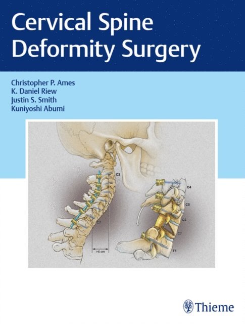 Kuniyoshi Abumi, Justin S. Smith, K. Daniel Riew, Christopher P. Ames - Cervical Spine Deformity Surgery, E-bok