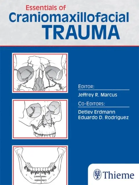 Jeffrey Marcus - Essentials of Craniomaxillofacial Trauma, E-bok. Tillgänglighet: Lägg i varukorg