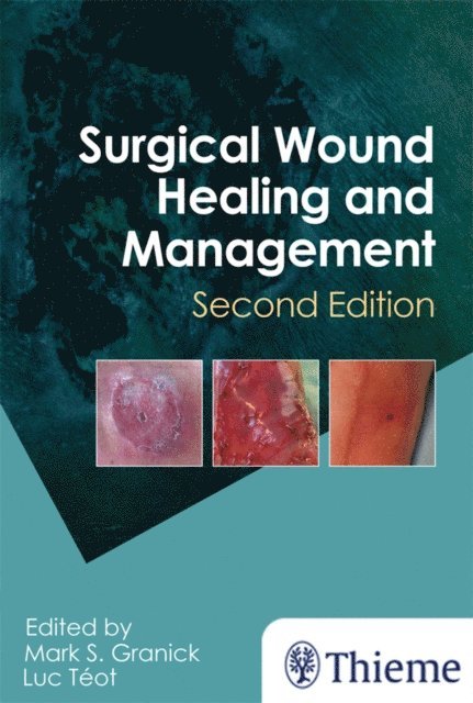 Luc Teot, Mark Granick - Surgical Wound Healing and Management, E-bok