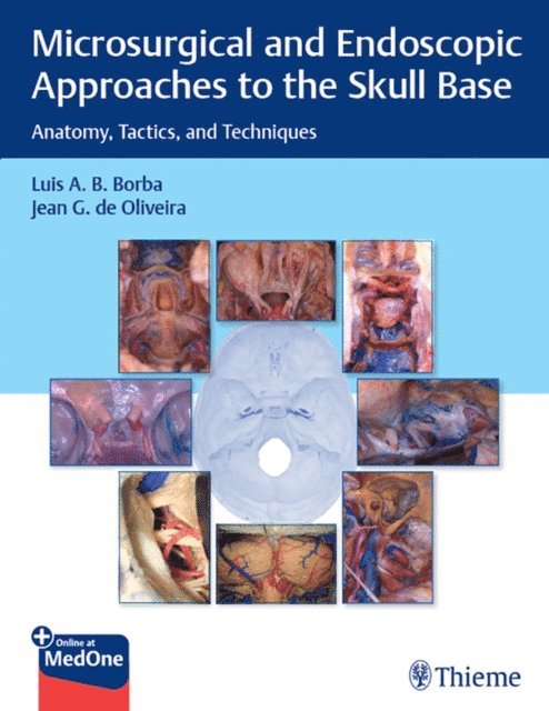 Jean  de Oliveira, Luis Borba - Microsurgical and Endoscopic Approaches to the Skull Base, E-bok