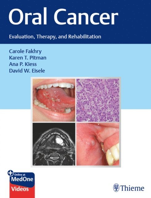 David W. Eisele, Ana P. Kiess, Karen T. Pitman, Carole Fakhry - Oral Cancer, E-bok