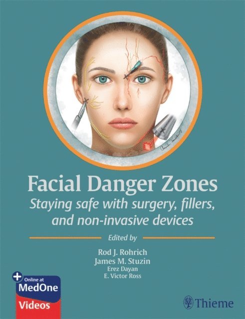 E. Victor Ross, Erez Dayan, James M. Stuzin, Rod J. Rohrich - Facial Danger Zones, E-bok
