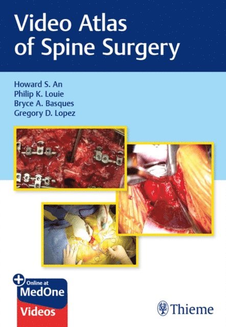 Gregory Lopez, Bryce Basques, Philip K. Louie, Howard S. An - Video Atlas of Spine Surgery, E-bok