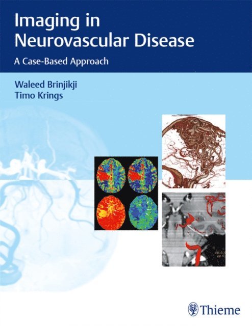 Timo Krings, Waleed Brinjikji - Imaging in Neurovascular Disease, E-bok