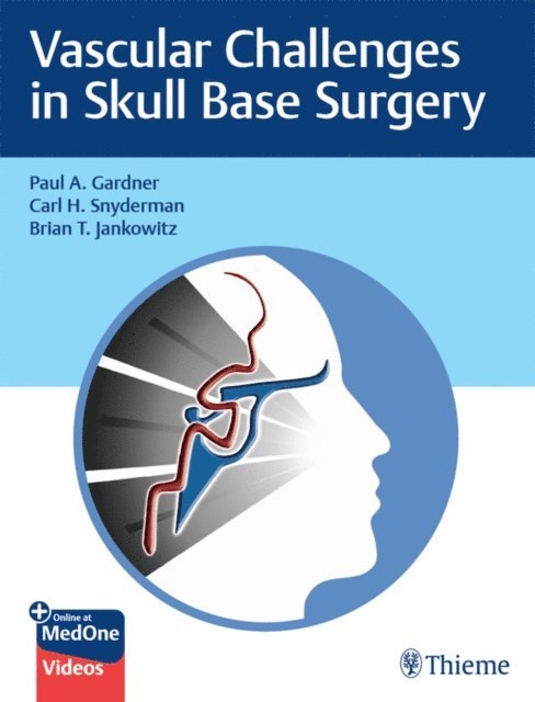 Brian Jankowitz, Carl Snyderman, Paul Gardner - Vascular Challenges in Skull Base Surgery, E-bok