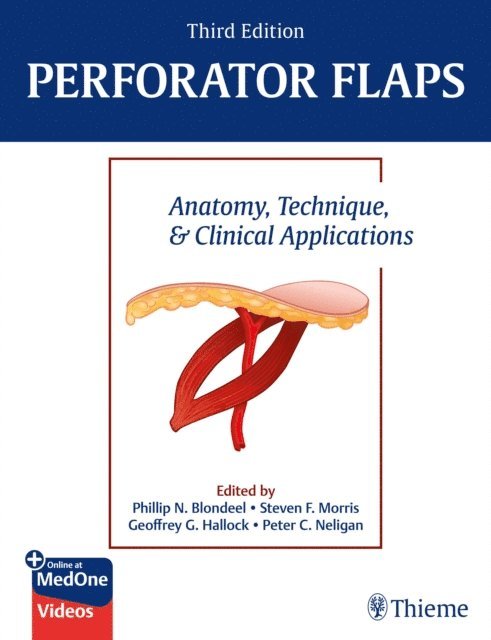 Peter C. Neligan, Geoffrey G. Hallock, Steven F. Morris, Phillip N. Blondeel - Perforator Flaps, E-bok