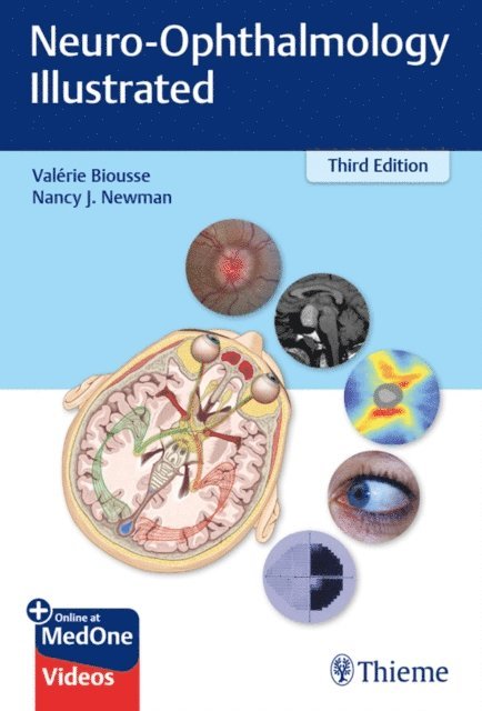 Nancy J. Newman, Valerie Biousse - Neuro-Ophthalmology Illustrated, E-bok