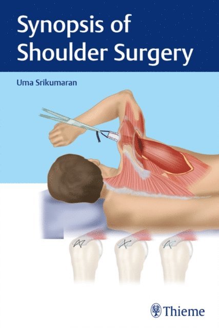 Uma Srikumaran - Synopsis of Shoulder Surgery, E-bok