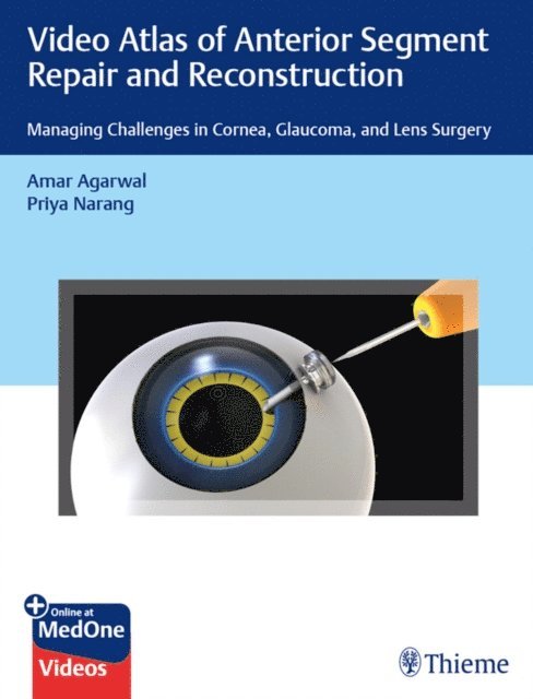 Priya Narang, Amar Agarwal - Video Atlas of Anterior Segment Repair and Reconstruction, E-bok
