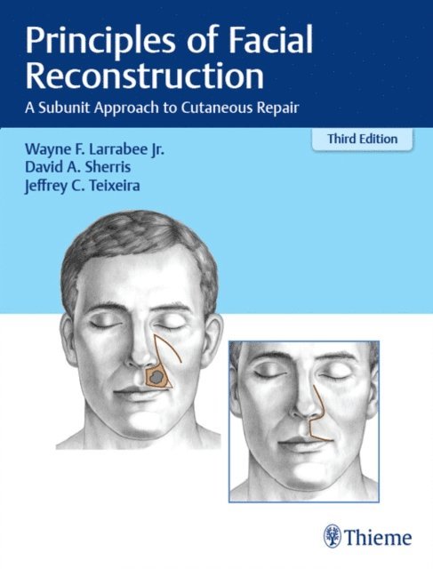 Jeffrey Teixeira, David A. Sherris, Wayne F. Larrabee - Principles of Facial Reconstruction, E-bok