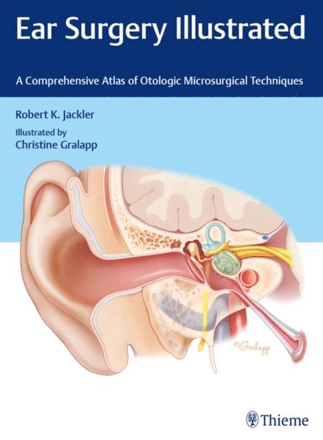 Robert K. Jackler - Ear Surgery Illustrated, E-bok