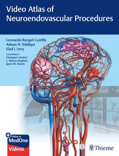 Jason Davies, L. Nelson Hopkins, Giuseppe Lanzino, Elad I. Levy, Adnan H. Siddiqui, Leonardo Rangel-Castilla - Video Atlas of Neuroendovascular Procedures, E-bok