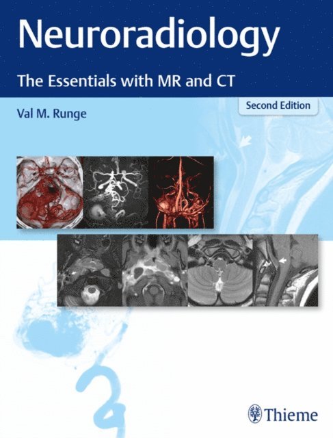 Val M. Runge - Neuroradiology, E-bok