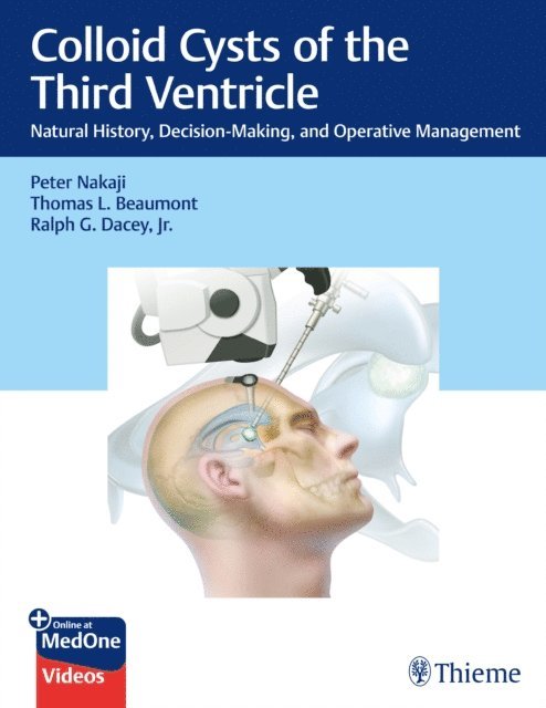 Jr. Ralph G. Dacey, Thomas Beaumont, Peter Nakaji - Colloid Cysts of the Third Ventricle, E-bok