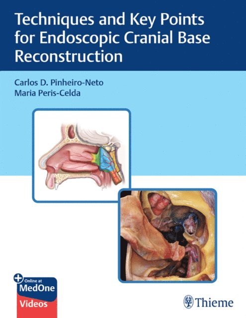 Maria Peris-Celda, Carlos Pinheiro-Neto - Techniques and Key Points for Endoscopic Cranial Base Reconstruction, E-bok