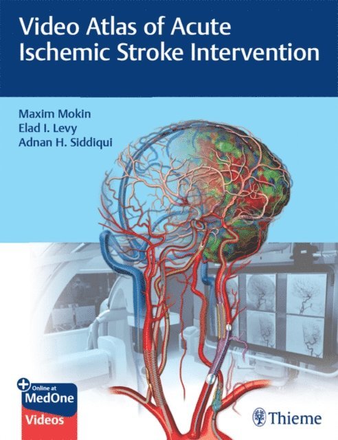 Adnan Hussain Siddiqui, Elad I Levy, Maxim Mokin - Video Atlas of Acute Ischemic Stroke Intervention, E-bok
