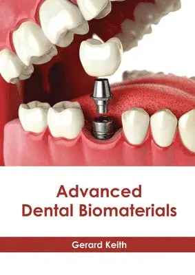 Gerard Keith - Advanced Dental Biomaterials, Inbunden. Tillgänglighet: Lägg i varukorg