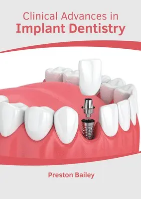 Preston Bailey - Clinical Advances in Implant Dentistry, Inbunden. Tillgänglighet: Lägg i varukorg