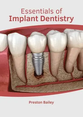 Preston Bailey - Essentials of Implant Dentistry, Inbunden. Tillgänglighet: Lägg i varukorg