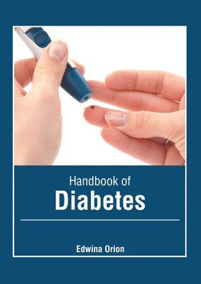 Edwina Orion - Handbook of Diabetes, Inbunden. Tillgänglighet: Lägg i varukorg