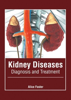 Alice Foster - Kidney Diseases: Diagnosis and Treatment, Inbunden. Tillgänglighet: Lägg i varukorg