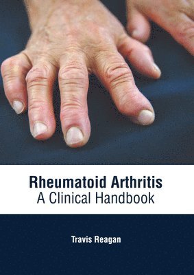 Travis Reagan - Rheumatoid Arthritis: A Clinical Handbook, Inbunden. Tillgänglighet: Lägg i varukorg