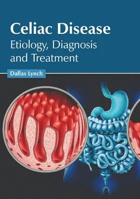 Dallas Lynch - Celiac Disease: Etiology, Diagnosis and Treatment, Inbunden. Tillgänglighet: Lägg i varukorg